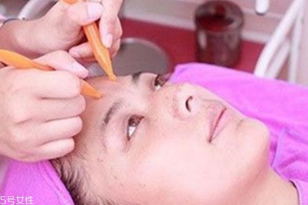 面部刮痧可以瘦臉嗎 有一定的作用 面部刮痧可以瘦臉嗎 有一定的作用