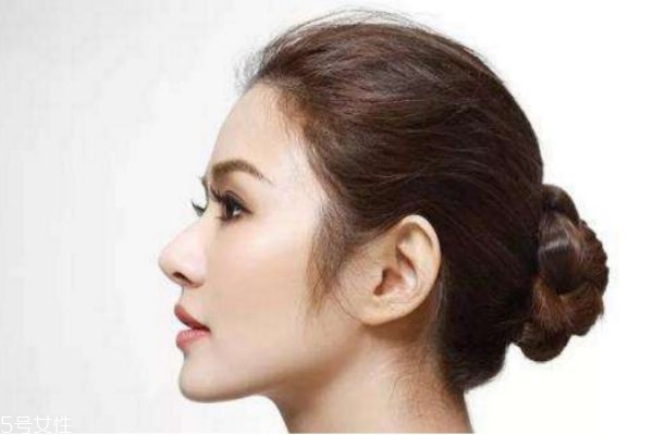 假體隆鼻有沒有危害 假體隆鼻可以一輩子嗎 假體隆鼻有沒有危害 假體隆鼻可以一輩子嗎