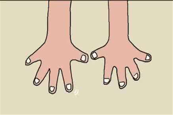 灰指甲癥狀是什么 原因是這樣 灰指甲癥狀是什么 原因是這樣