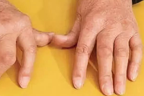 夏天濕氣重怎么辦 夏天濕氣重這樣調(diào)理 夏天濕氣重怎么辦 夏天濕氣重這樣調(diào)理