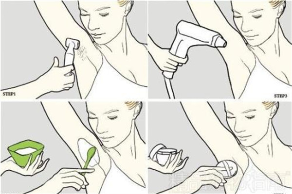 汗毛多怎么去除 汗毛多是什么原因 汗毛多怎么去除 汗毛多是什么原因