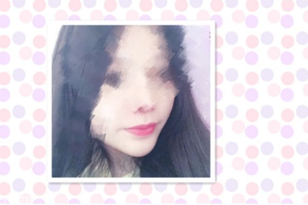 墊下巴能改變臉型嗎 墊下巴后恢復(fù)過程 墊下巴能改變臉型嗎 墊下巴后恢復(fù)過程