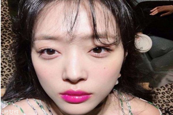 激光去痘印有風(fēng)險嗎 激光去痘印的風(fēng)險 激光去痘印有風(fēng)險嗎 激光去痘印的風(fēng)險