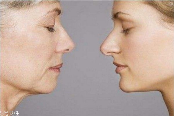 額頭皮膚松弛怎么辦 皮膚松弛最有效的方法 額頭皮膚松弛怎么辦 皮膚松弛最有效的方法