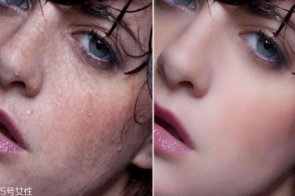 果酸換膚多久做一次 果酸換膚間隔時(shí)間 果酸換膚多久做一次 果酸換膚間隔時(shí)間