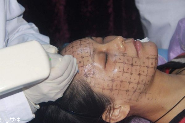 熱瑪吉會反彈嗎 熱瑪吉維持時間 熱瑪吉會反彈嗎 熱瑪吉維持時間