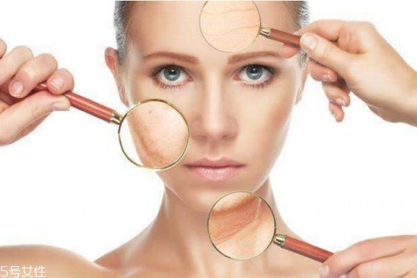 油皮變干皮是好事么 油皮變干皮是什么原因 油皮變干皮是好事么 油皮變干皮是什么原因