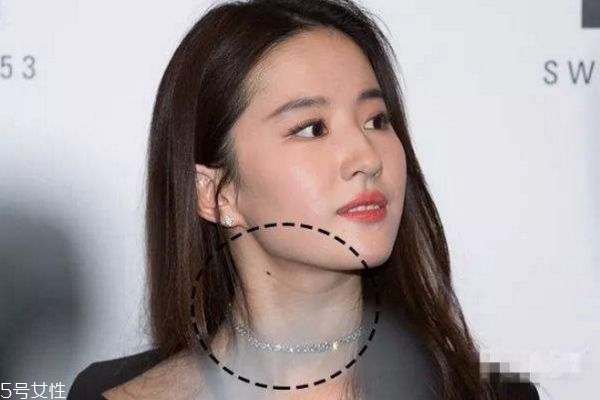 頸紋和胖有關(guān)系嗎 瘦了是不是頸紋就會沒 頸紋和胖有關(guān)系嗎 瘦了是不是頸紋就會沒