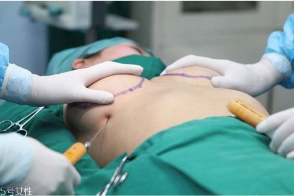 假體隆胸后多久才能趴著睡 假體隆胸趴著睡的好處 假體隆胸后多久才能趴著睡 假體隆胸趴著睡的好處