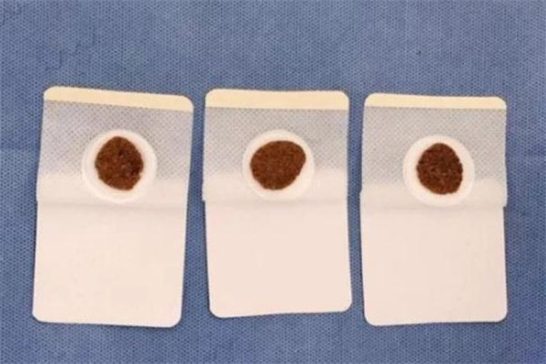 貼三伏貼會推遲月經嗎 貼三伏貼會影響月經嗎 貼三伏貼會推遲月經嗎 貼三伏貼會影響月經嗎