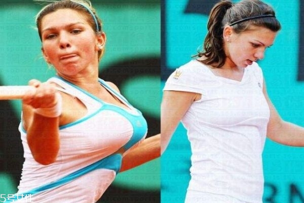 縮胸手術(shù)是什么 為什么要做縮胸手術(shù) 縮胸手術(shù)是什么 為什么要做縮胸手術(shù)