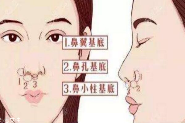 鼻基底填充有無(wú)副作用呢 鼻基底填充的價(jià)格有什么呢 鼻基底填充有無(wú)副作用呢 鼻基底填充的價(jià)格有什么呢