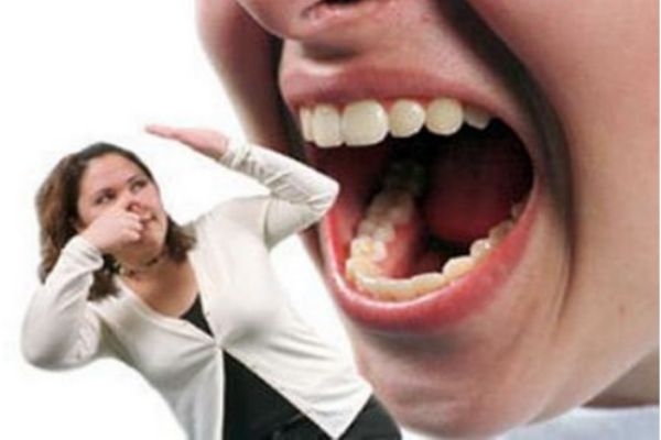 口臭和胃有關(guān)系嗎 口臭怎樣治療 口臭和胃有關(guān)系嗎 口臭怎樣治療