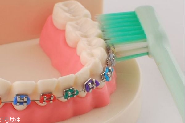 支抗釘有哪些用途 什么情況需要打支抗釘 支抗釘有哪些用途 什么情況需要打支抗釘