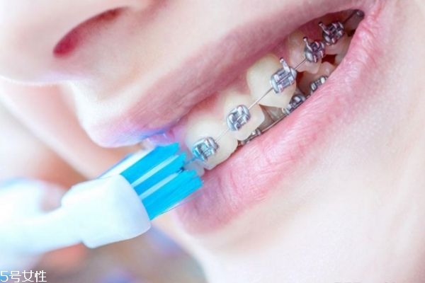 打支抗釘疼嗎 支抗釘打與不打的區(qū)別 打支抗釘疼嗎 支抗釘打與不打的區(qū)別