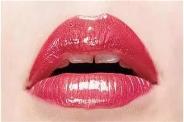 嘴角上揚(yáng)手術(shù)后悔了怎么辦 嘴角上揚(yáng)手術(shù)失敗 嘴角上揚(yáng)手術(shù)后悔了怎么辦 嘴角上揚(yáng)手術(shù)失敗