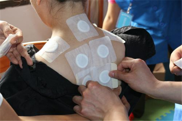 冬病夏治的原理和好處 冬病夏治三伏貼 冬病夏治的原理和好處 冬病夏治三伏貼