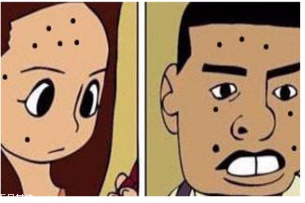 點痣會留疤嗎 點痣痛嗎 點痣會留疤嗎 點痣痛嗎