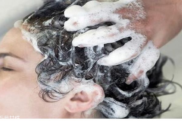 頭皮屑造成的原因有什么呢 頭皮屑太多應(yīng)該怎么辦呢 頭皮屑造成的原因有什么呢 頭皮屑太多應(yīng)該怎么辦呢