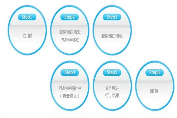 什么是愛(ài)貝芙呢 愛(ài)貝芙有什么用呢