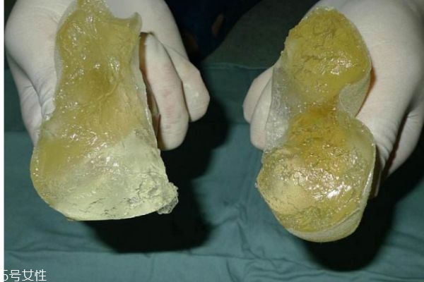 隆胸有什么禁忌人群?jiǎn)?隆胸需要注意什么呢 隆胸有什么禁忌人群?jiǎn)?隆胸需要注意什么呢