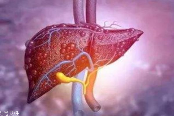 肝不好的人群有什么癥狀呢 肝不好應(yīng)該怎么辦呢 肝不好的人群有什么癥狀呢 肝不好應(yīng)該怎么辦呢