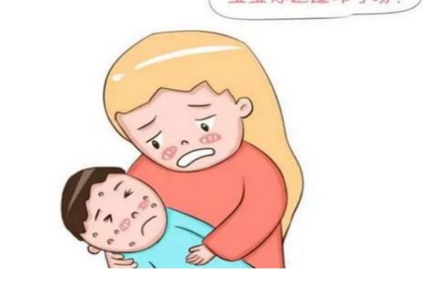 如何知道是不是得了水痘呢 得水痘有什么先兆癥狀呢 如何知道是不是得了水痘呢 得水痘有什么先兆癥狀呢