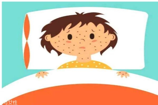 如何知道是不是得了水痘呢 得水痘有什么先兆癥狀呢 如何知道是不是得了水痘呢 得水痘有什么先兆癥狀呢
