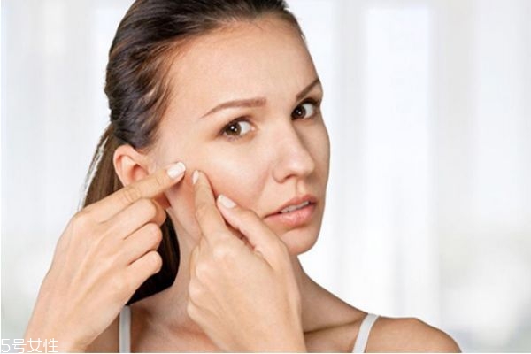 怎么去閉口粉刺 去閉口粉刺最有效的方法 怎么去閉口粉刺 去閉口粉刺最有效的方法