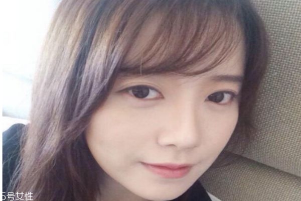 怎么去痘印 去痘印的日常方法 怎么去痘印 去痘印的日常方法