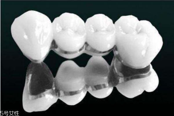 哪些人不適合做烤瓷牙 做烤瓷牙后牙齒還能矯正嗎 哪些人不適合做烤瓷牙 做烤瓷牙后牙齒還能矯正嗎