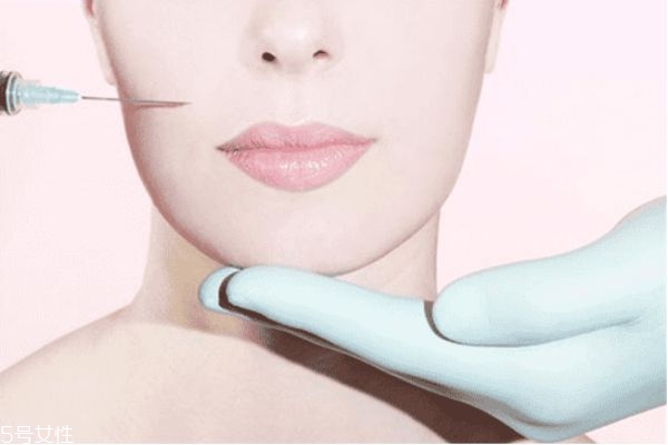 法令紋填充前后照片 填充法令紋后悔死 法令紋填充前后照片 填充法令紋后悔死