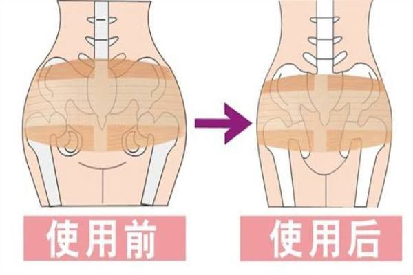 產(chǎn)后胯骨變寬怎么恢復(fù) 產(chǎn)后簡(jiǎn)單瘦身方法有哪些 產(chǎn)后胯骨變寬怎么恢復(fù) 產(chǎn)后簡(jiǎn)單瘦身方法有哪些