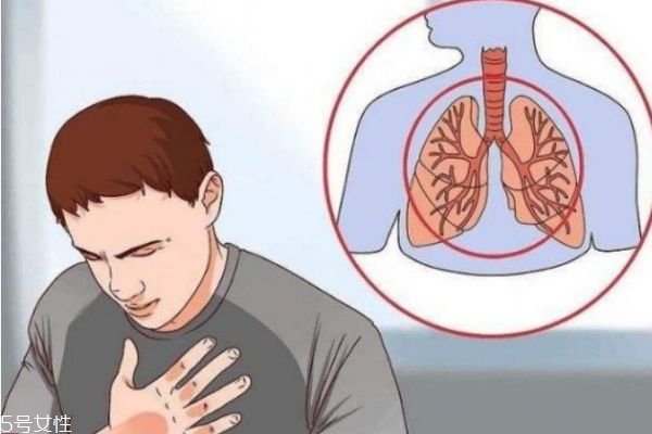 什么是慢性支氣管炎呢 慢性支氣管炎有什么危害呢 什么是慢性支氣管炎呢 慢性支氣管炎有什么危害呢