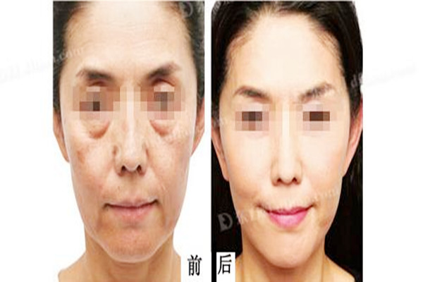 為什么洗眉后顏色更深 洗眉有危害嗎 為什么洗眉后顏色更深 洗眉有危害嗎