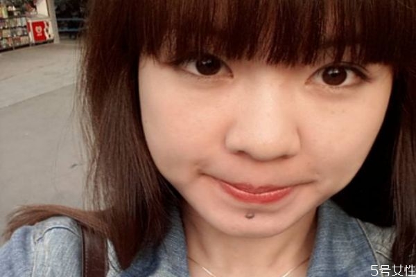 臉部的長的痣可以去掉嗎 臉部的痣有什么講究嗎 臉部的長的痣可以去掉嗎 臉部的痣有什么講究嗎