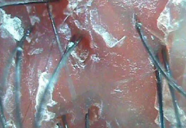 早上洗頭衰老的快嗎 為什么早上洗頭容易衰老 早上洗頭衰老的快嗎 為什么早上洗頭容易衰老