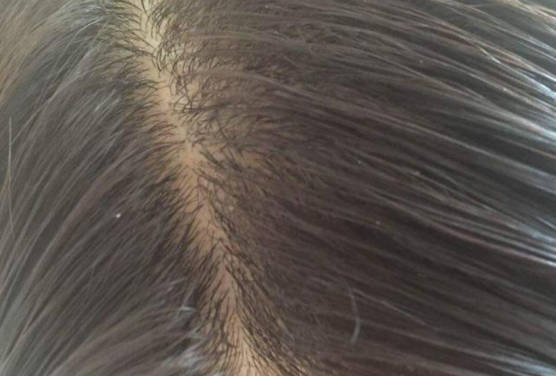 早上洗頭衰老的快嗎 為什么早上洗頭容易衰老 早上洗頭衰老的快嗎 為什么早上洗頭容易衰老