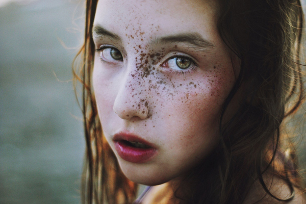 點斑后多久痂會全部掉 點斑后要注意什么 點斑后多久痂會全部掉 點斑后要注意什么