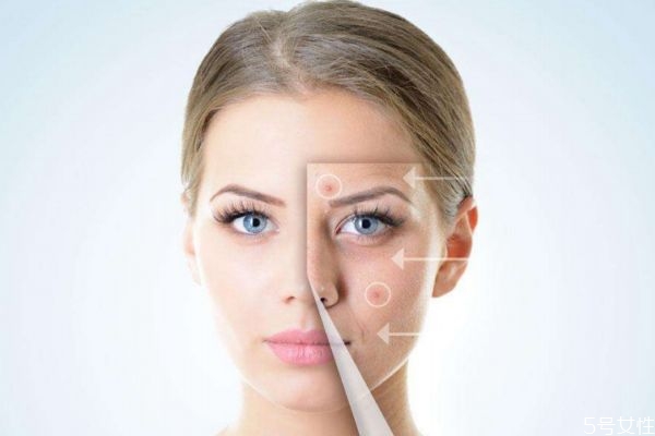 激素臉有什么危害呢 激素臉應(yīng)該怎么治療呢 激素臉有什么危害呢 激素臉應(yīng)該怎么治療呢