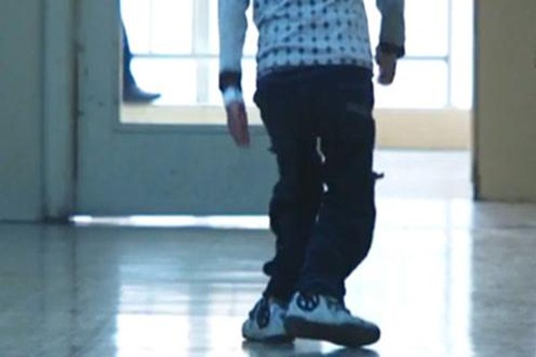 為什么會導致佝僂病 佝僂病前期癥狀有哪些 為什么會導致佝僂病 佝僂病前期癥狀有哪些