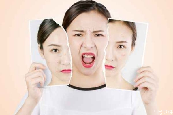 冬天卡粉嚴(yán)重怎么辦 化妝卡粉起皮解決小妙招 冬天卡粉嚴(yán)重怎么辦 化妝卡粉起皮解決小妙招