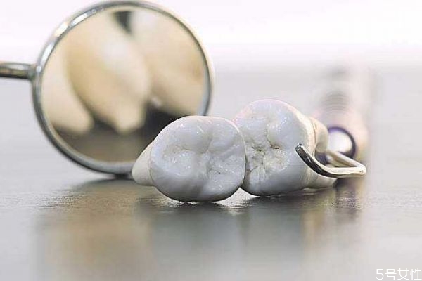 年輕人牙齒松動應(yīng)該怎么辦呢 年輕人牙齒松動應(yīng)該怎么辦呢