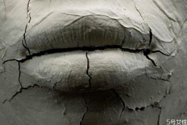 什么是唇炎呢 唇炎有什么危害呢 什么是唇炎呢 唇炎有什么危害呢