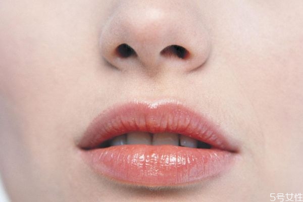 唇炎一般是怎么造成的呢 唇炎的種類有什么呢 唇炎一般是怎么造成的呢 唇炎的種類有什么呢