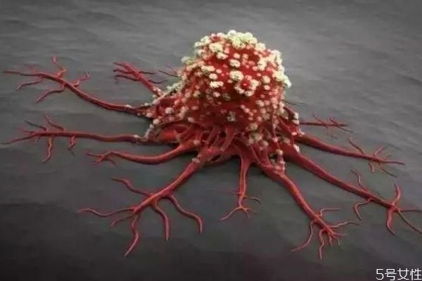 什么是腸炎呢 腸炎造成的原因有什么呢 什么是腸炎呢 腸炎造成的原因有什么呢