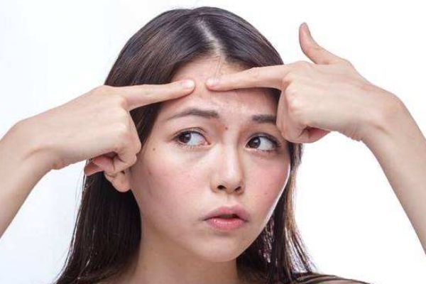 為什么不能用手擠痘痘呢 擠痘痘的危害有什么呢 為什么不能用手擠痘痘呢 擠痘痘的危害有什么呢