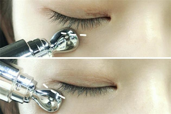 朵拉朵尚電動眼霜使用方法 朵拉朵尚電動眼霜適合年齡 朵拉朵尚電動眼霜使用方法 朵拉朵尚電動眼霜適合年齡