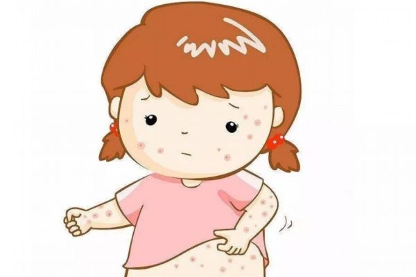 痱子是怎么造成的呢 為什么會有痱子呢 痱子是怎么造成的呢 為什么會有痱子呢