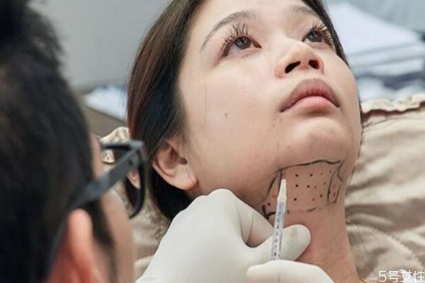 雙下巴溶脂后幾天看見效果 雙下巴溶脂效果是永久的嗎 雙下巴溶脂后幾天看見效果 雙下巴溶脂效果是永久的嗎